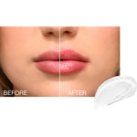 The Lip Plumper ***NIEUW***